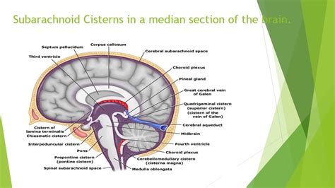 Subarachnoid cisterns .